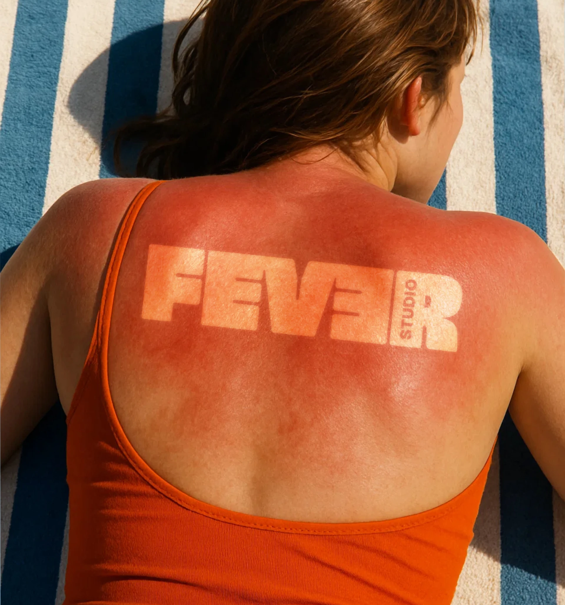 Coup de soleil Fever